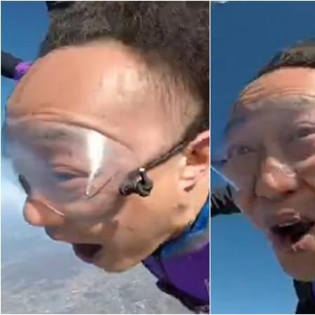 无需羞怯！发际线告别分离，拯救脱发烦恼，重拾自信迎接新生活